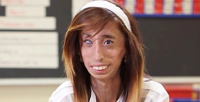 Lizzie Velásquez - Bio, Facts, Family Life of Motivational 