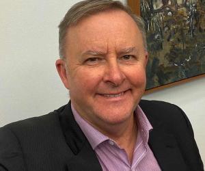 Anthony Albanese