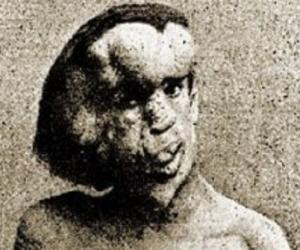 Joseph Merrick