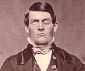 Phineas Gage