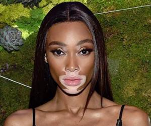 Winnie Harlow Biography