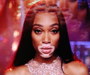 Winnie Harlow