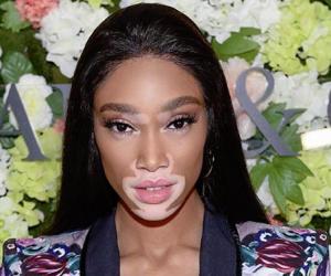 Winnie Harlow