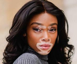 Winnie Harlow